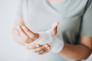 Woman Holding Hand Wrapped in Bandage